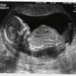 body length (Jan 26, 2008)