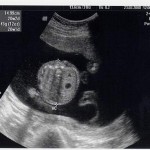 head measurement (Feb 23, 2008)